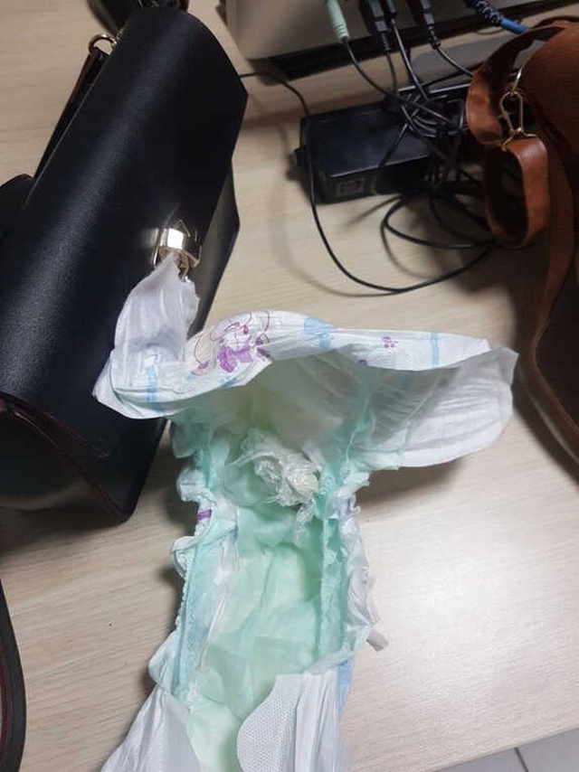 Acımasız Anne ile Baba, Bebeğin Üzerindeki Bezde Eroin Sakladı