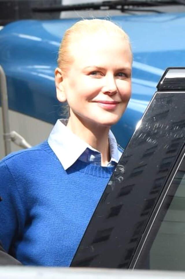 Nicole Kidman'ın Kulak Memesi, Güzelliğine Gölge Düşürdü