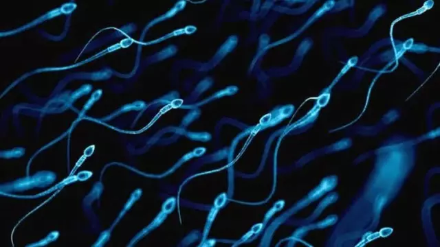 Düşük Sperm Sayısı Sağlık Sorunu Habercisi Olabilir