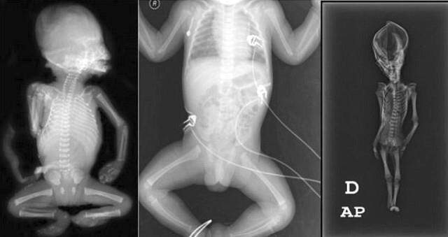 Uzaylı Zannedilen 15 Cm'lik Mumyanın Gizemi Çözüldü