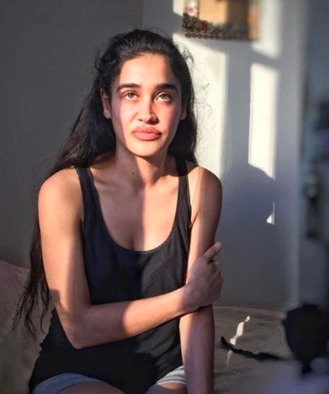 Hayat Devam Ediyor'da Çocuk Gelin Rolüyle Ünlenen Meltem Miraloğlu, Estetik İddialarına Yanıt Verdi