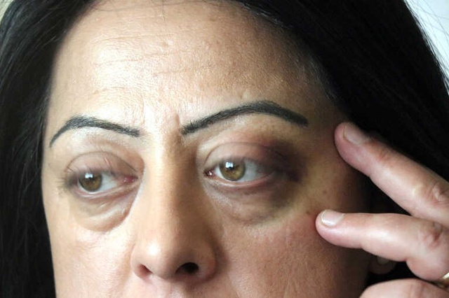 Polis, Hamile Kadın ve Eşine Saldırdı, Silahını Çekip Ateş Etti