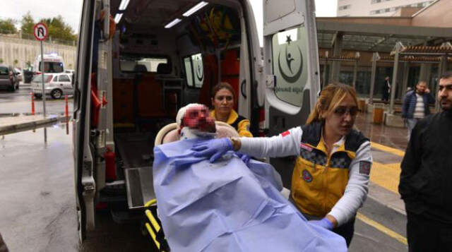 Eski Karısının Kızgın Yağla Yakıp Satırla Yaraladığı Koca, Mahkemede Soyunup Yaralarını Gösterdi