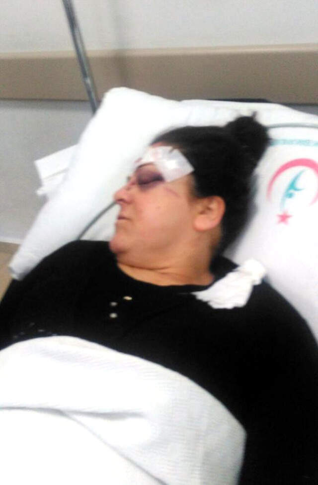 Cani Koca, Boşanma Davası Açan Karısına Tornavida ile Saldırdı Cani Koca, Boşanma Davası Açan Karısına Tornavida ile Saldırdı