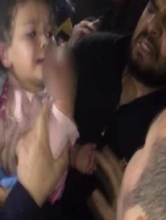 Asansör Kapısına Eli Sıkışan Çocuğun İki Parmağı Koptu Bozuk Asansör Kapısına Eli Sıkışan Minik Kızın İki Parmağı Koptu