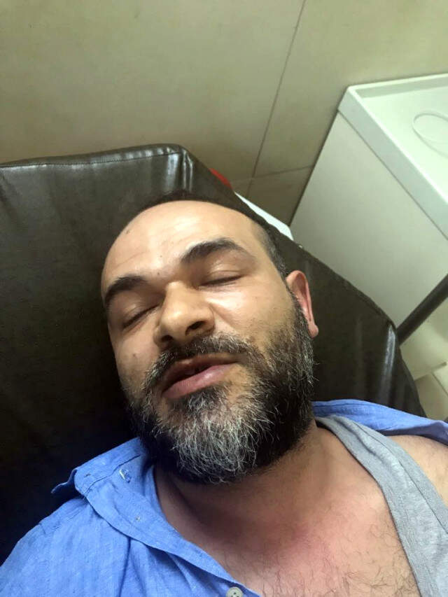 Arkadaşına Borcunu Ödememek İçin Kendisini Tabancayla Vurdurtmuş
