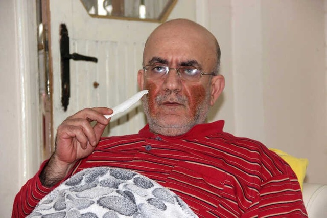 Yüzünde Çıkan Yaralar Nedeniyle Günden Güne Eriyor