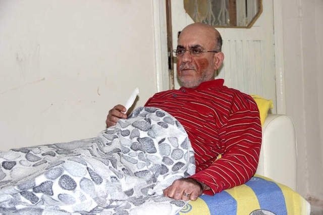 Yüzünde Çıkan Yaralar Nedeniyle Günden Güne Eriyor
