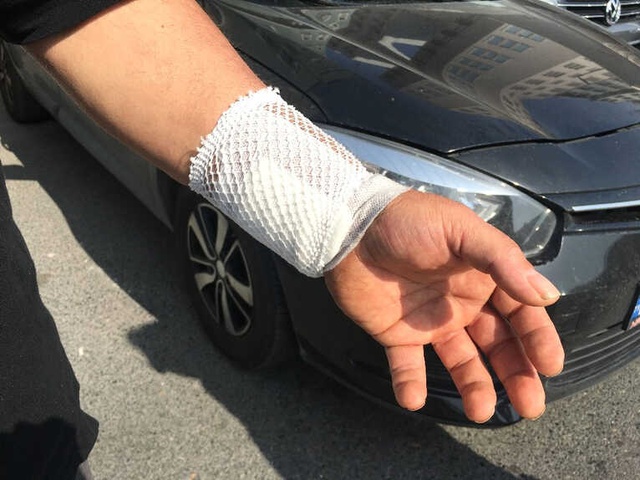 Taksici, UBER Şoförü Zannettiği Servisçiyi Bıçakladı! O Anlar Kamerada