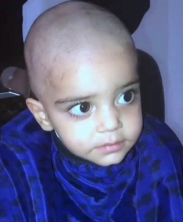 Ceren Hindistan Kemoterapi Öncesi Kızının Saçlarını Tıraş Etti