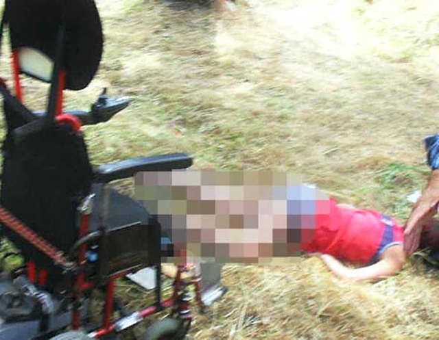 Engelli Kadını Dövüp Tekerlekli Sandalyesinden Atarak Kafasını ve 2 Bacağını Kırdılar
