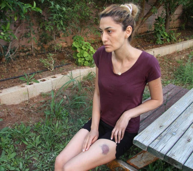 Eski Koca, Fuhuş Yapmak İstemeyen Karısını Çocuklarının Gözü Önünde 11. Kattan Atmaya Çalıştı