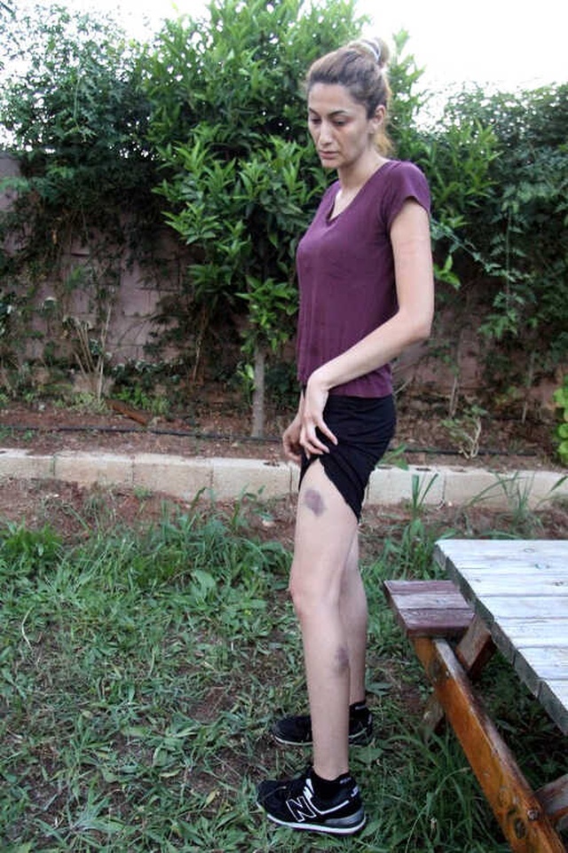 Eski Koca, Fuhuş Yapmak İstemeyen Karısını Çocuklarının Gözü Önünde 11. Kattan Atmaya Çalıştı