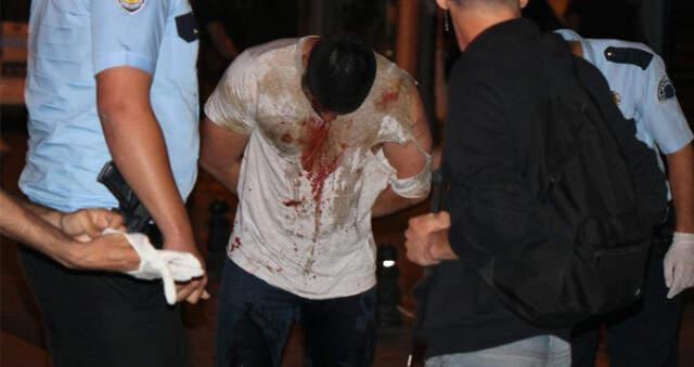 Önce Arkadaşını Bıçakladı, Ardından Gözaltına Alınmamak için Kendini Kesti