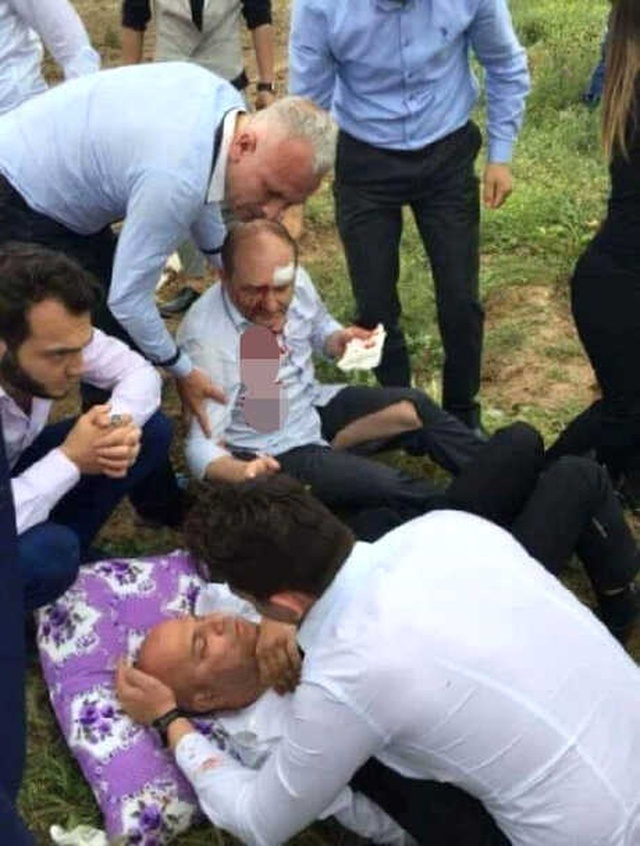 Samsun'da Dehşet! Alkollü Saldırgan Önüne Geleni Bıçakladı