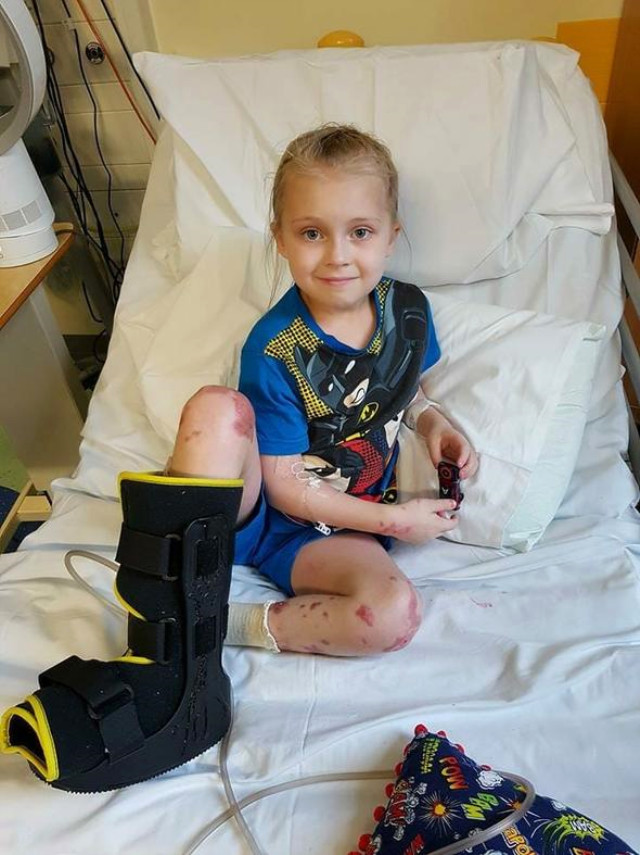 Vücudu Morarmaya Başlayan Küçük Kıza Geç Teşhis Konulunca Bacağını Kaybetti