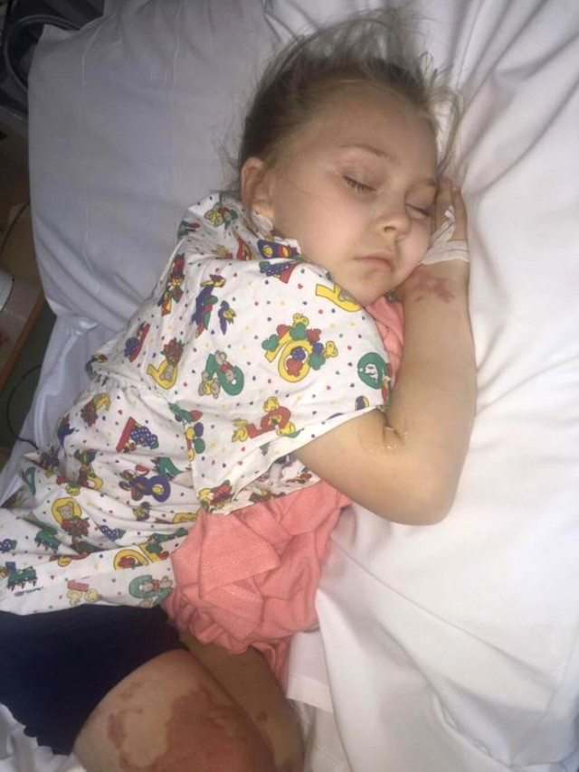 Vücudu Morarmaya Başlayan Küçük Kıza Geç Teşhis Konulunca Bacağını Kaybetti
