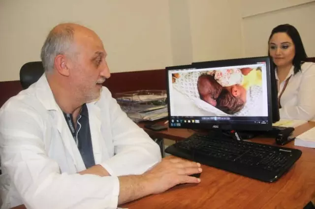 Hatay'da İki Kafalı Bebek Dünyaya Geldi