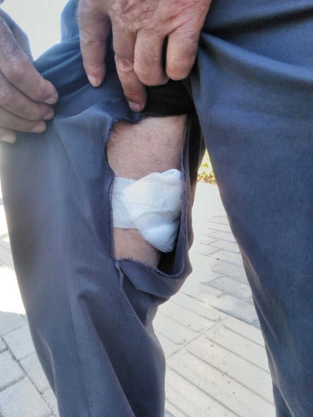 Bursa'da Pitbull Cinsi Köpek Yaşlı Adama Saldırdı