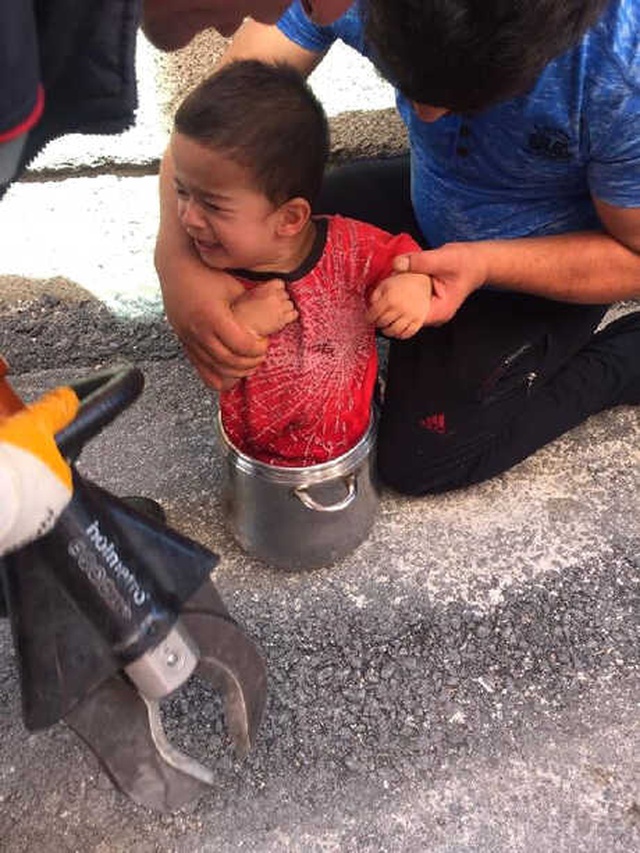 Düdüklü Tencereye Sıkışan 2 Yaşındaki Ahmet'i İtfaiye Kurtardı