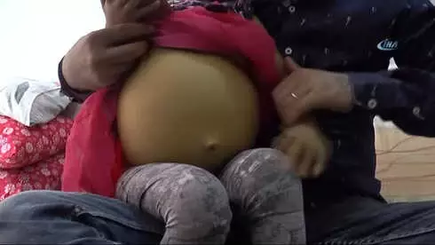 Minik Asel Türk Vatandaşı Olamazsa Hayatını Kaybedebilir