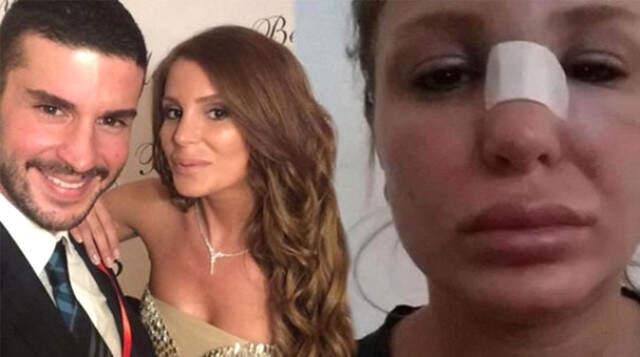 Oyuncu Berk Oktay, Çıplak Fotoğraflarının Sızmasıyla İlgili İlk Kez Konuştu