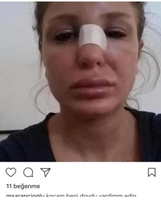 Eşi Berk Oktay'ın Özel Fotoğraflarını Paylaşan Merve Şarapçıoğlu Kimdir?