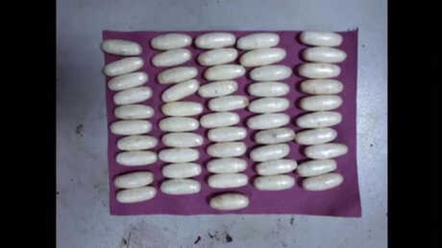 Havalimanında Operasyon! Brezilya'dan Gelen Kadının Midesinden 51 Kapsül Kokain Çıktı