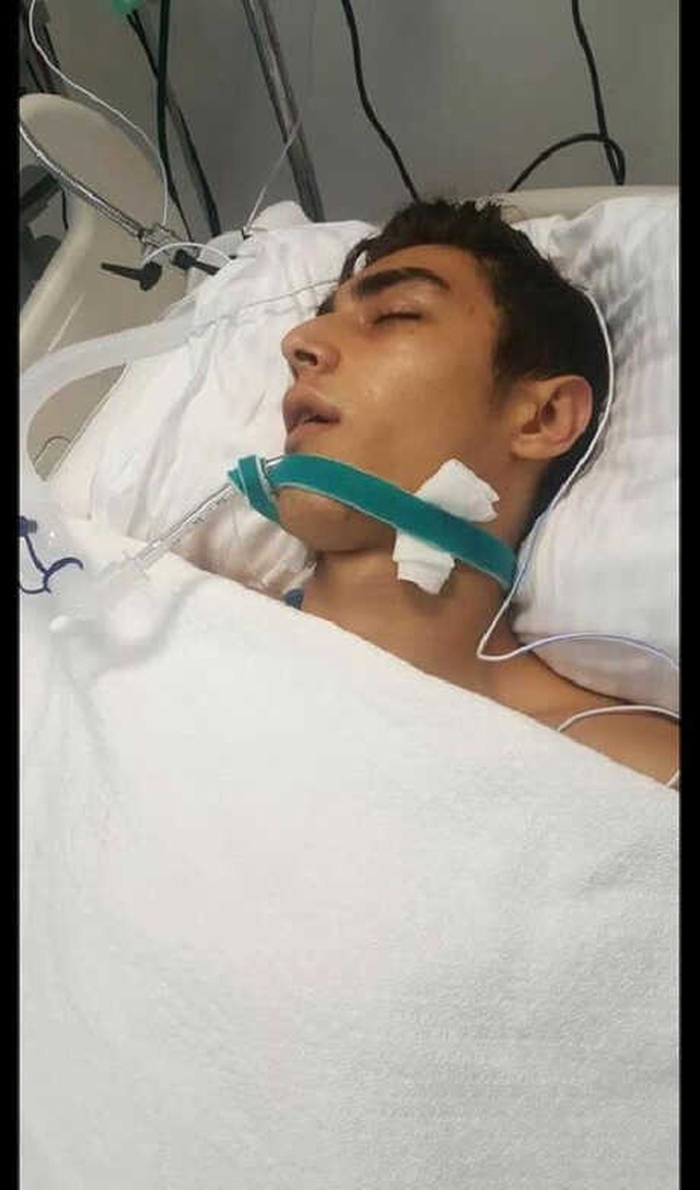 Hatay'da, Çakmak Gazı Çeken 18 Yaşındaki Genç Hayatını Kaybetti