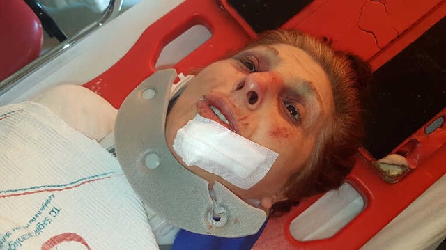 Maskeli Soyguncular, Kendilerine Direnen Yaşlı Kadını Öldüresiye Dövdü