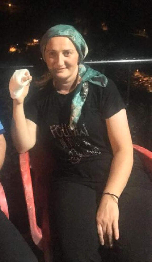 Rize'de, Balkonda Oturan Kadının Parmağına Maganda Kurşunu İsabet Etti