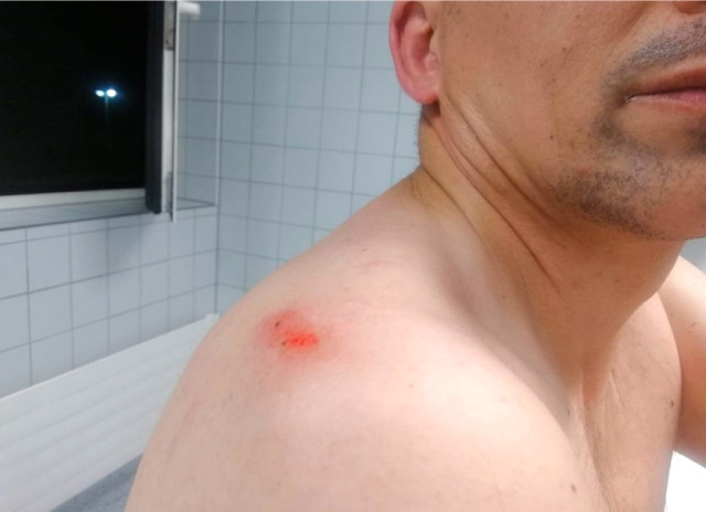 Almanya'da, Türk Taksiciye Irkçı Saldırı: Hamam Böcekleri, Anavatanınıza Defolun