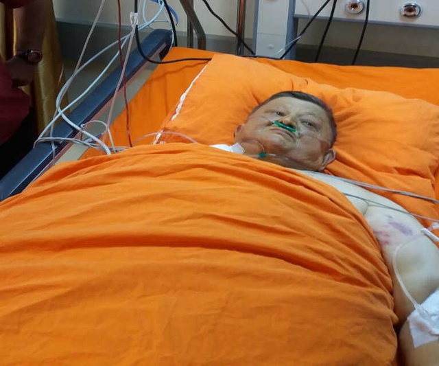 'Şişko Nuri' Lakaplı Sıtkı Sezgin, Yaşam Mücadelesi Veriyor