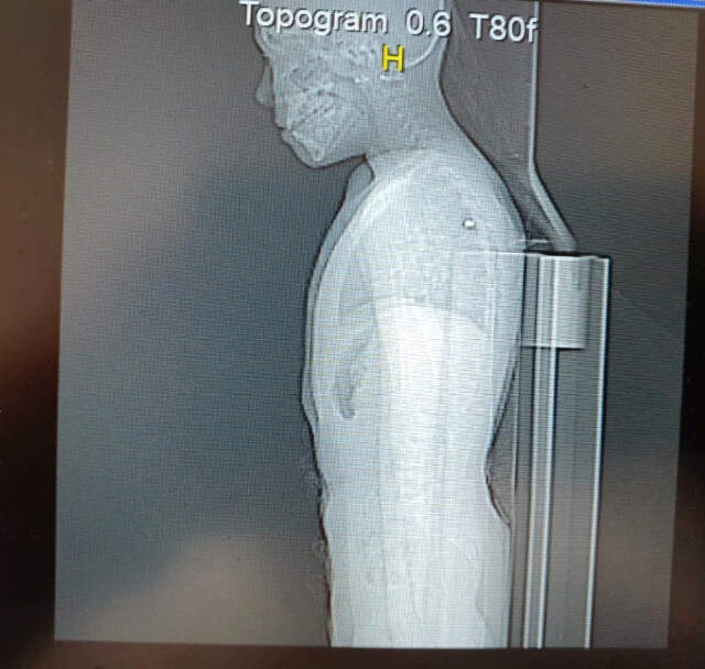 Parktaki Çocuğu Vuran Şüpheli Hakkında Yeniden Gözaltı Kararı Verildi Parktaki Çocuğu Vuran Şüpheli Hakkında Yeniden Gözaltı Kararı Verildi