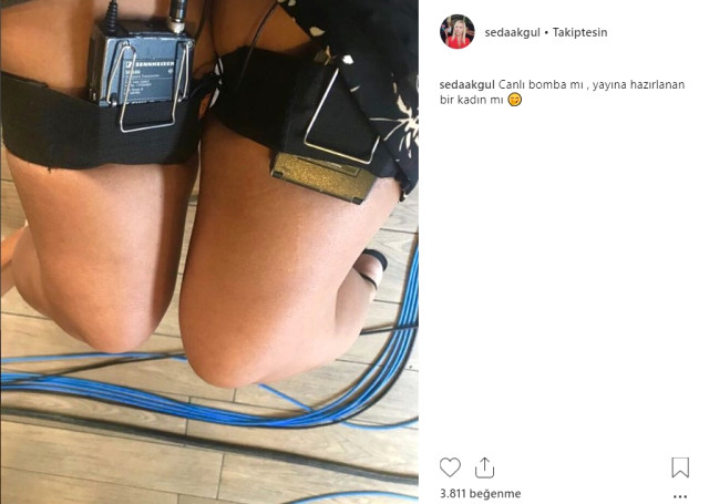 İlginç Paylaşımlar Yapan Seda Akgül, Bu Sefer de Bacaklarına Takılan Mikrofonların Fotoğrafını Paylaştı