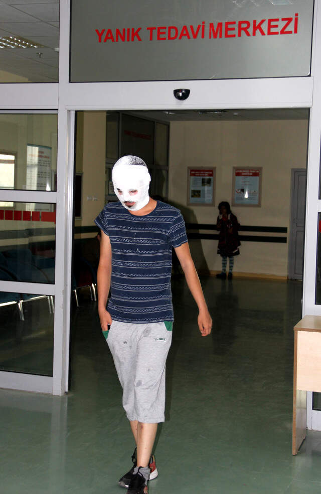 Merdiven Altı Krem, Talihsiz Vatandaşın Yüz Derisini Tamamen Yaktı Merdiven Altı Krem, Talihsiz Vatandaşın Yüz Derisini Tamamen Yaktı