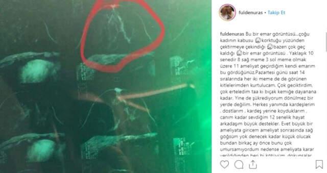 Kanser Teşhisi Konmuştu! Fulden Uras Kimdir? Kanser Teşhisi Konmuştu! Fulden Uras Kimdir?