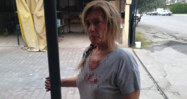 Balıkesir'de Talihsiz Kadın, Köpeklerini Gezdirirken Taşlı Saldırıya Uğradı Balıkesir'de Talihsiz Kadın, Köpeklerini Gezdirirken Taşlı Saldırıya Uğradı