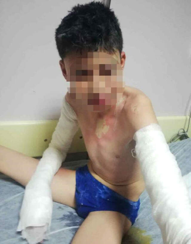 Konya'da Cani Kadın, Kavga Ettiği Komşusunun 3 Çocuğuna Kezzap Attı Konya'da Cani Kadın, <a class='keyword-sd' href='/kavga/' title='Kavga'>Kavga</a> Ettiği Komşusunun 3 Çocuğuna Kezzap Attı