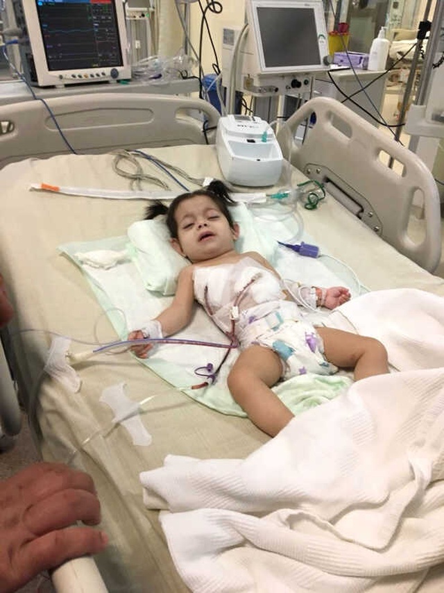 Yemek Borusu Olmayan 1,5 Yaşındaki Hiranur'un Yutkunursa Ölme İhtimali Var