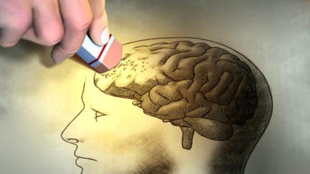 Bugün 21 Eylül Dünya Alzheimer Günü! Alzheimer Hastalığı Nedir, Nasıl Anlaşılır?