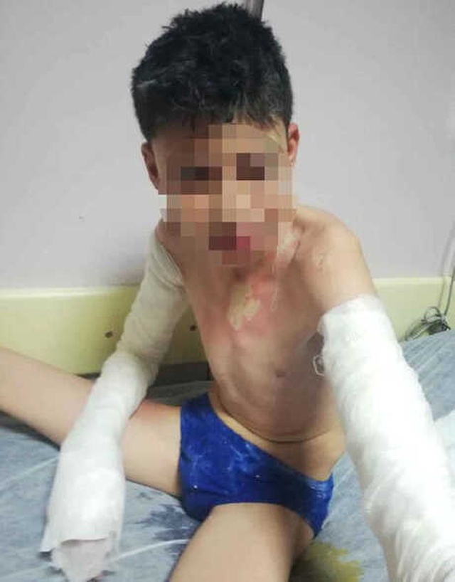 Konya'da, Anne ve 3 Çocuğunu Kezzapla Yakan Cani Komşu Konuştu: Olayı Hatırlamıyorum