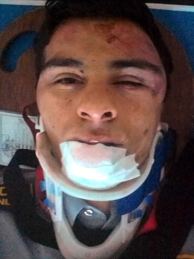 Güvenlik Görevlisini Kendi Copuyla Dövüp 'Öldü' Diye Bırakan Şüphelilere, Yıllar Sonra 9 Ay Ceza Verildi