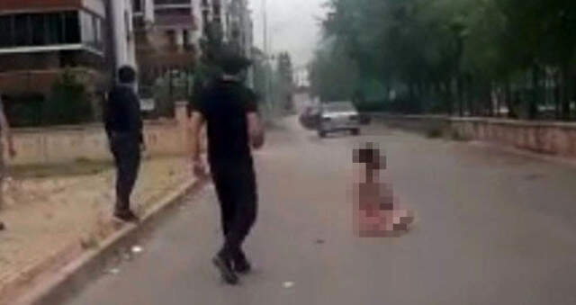 Bursa'da Sevgilisi Tarafından Benzin Dökülerek Yakılan Kadının Korkunç Görüntüleri Ortaya Çıktı Bursa'da Sevgilisi Tarafından Benzin Dökülerek Yakılan Kadının Korkunç Görüntüleri Ortaya Çıktı