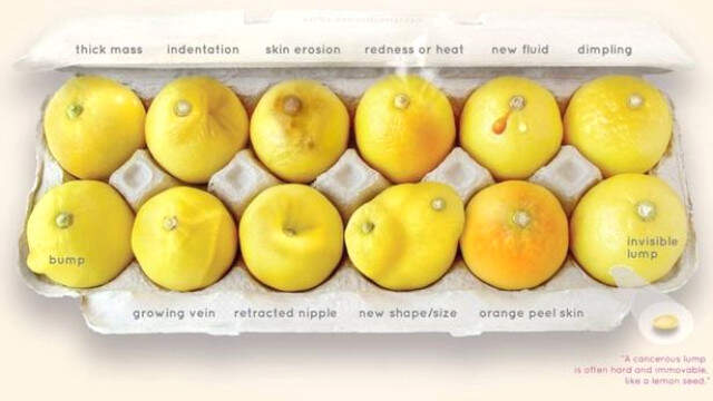 İnternetteki Bu Fotoğrafı Görünce Kanser Olduğunu Anladı Kanser Olan Kadın, İnternetteki Bu Fotoğrafı Görünce <a class='keyword-sd' href='/meme-kanseri-2/' title='Meme Kanseri'>Meme Kanseri</a> Olduğunu Anladı