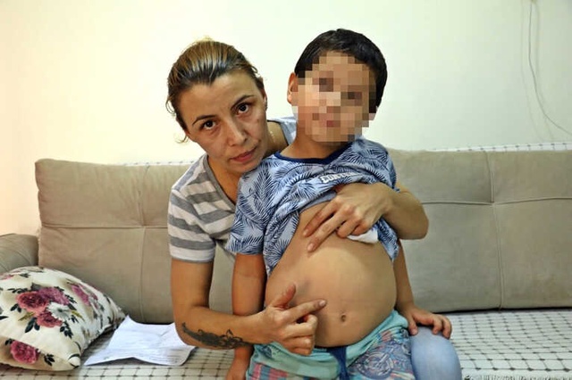 Antalya'da, Kreş Sahibi 5 Yaşındaki Hiperaktif Çocuğu Tekme Tokat Dövdü