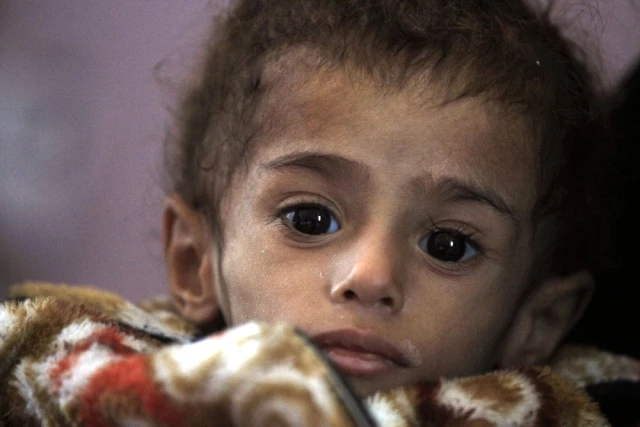 Yemenli Çocuklar Hayatta Kalmak İçin Üzüm Yaprağı Yiyor
