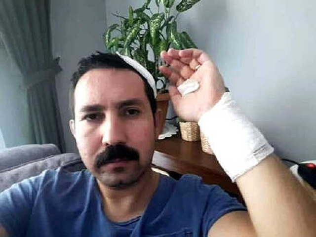 İş Yerlerini Denetleyen Gıda Mühendisi, Evinin Önünde Beyzbol Sopalı Saldırıya Uğradı