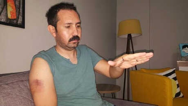 İş Yerlerini Denetleyen Gıda Mühendisi, Evinin Önünde Beyzbol Sopalı Saldırıya Uğradı