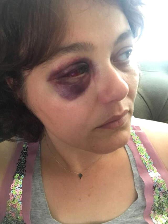 Kadıköy'de Saldırgan, 